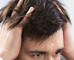 Tratamientos para la caída del cabello en hombres